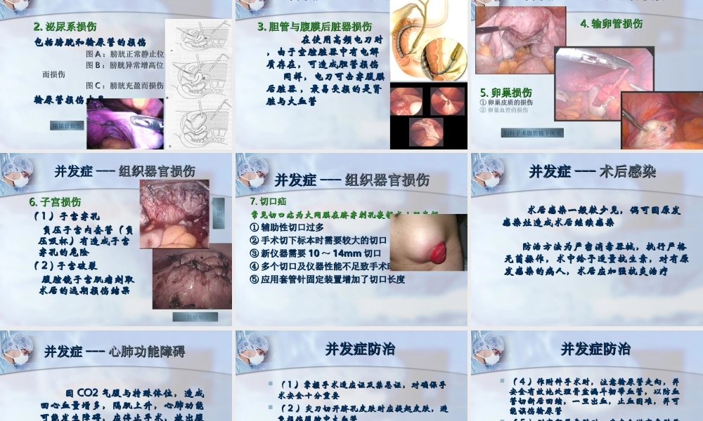 5[1].手术并发症与防治原始(from-Prof.Li-Hong).ppt