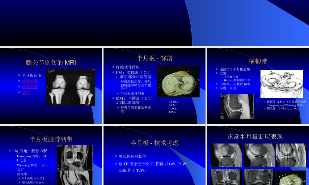 MRI膝关节.ppt