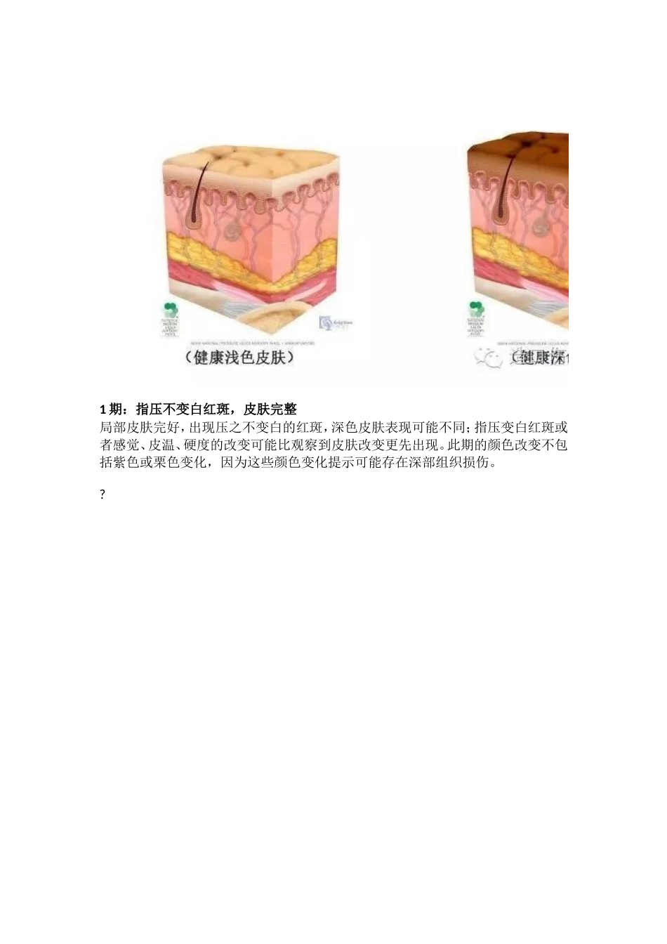 NPUAP最新版压力性损伤定义与分期.doc_第2页