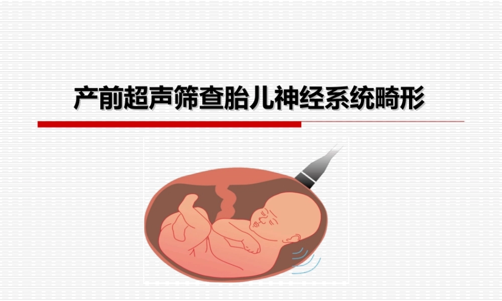 4-杨太珠产前超声筛查胎儿神经系统畸形-2016.5.27.ppt