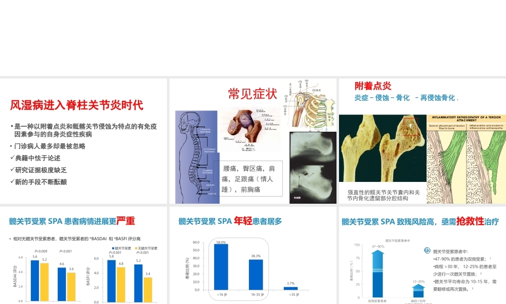 AS髋关节受累的思考.ppt