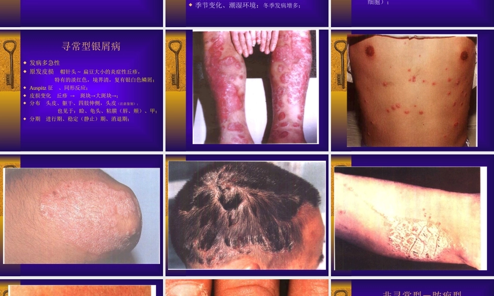 P-07红斑鳞屑性皮肤病.ppt