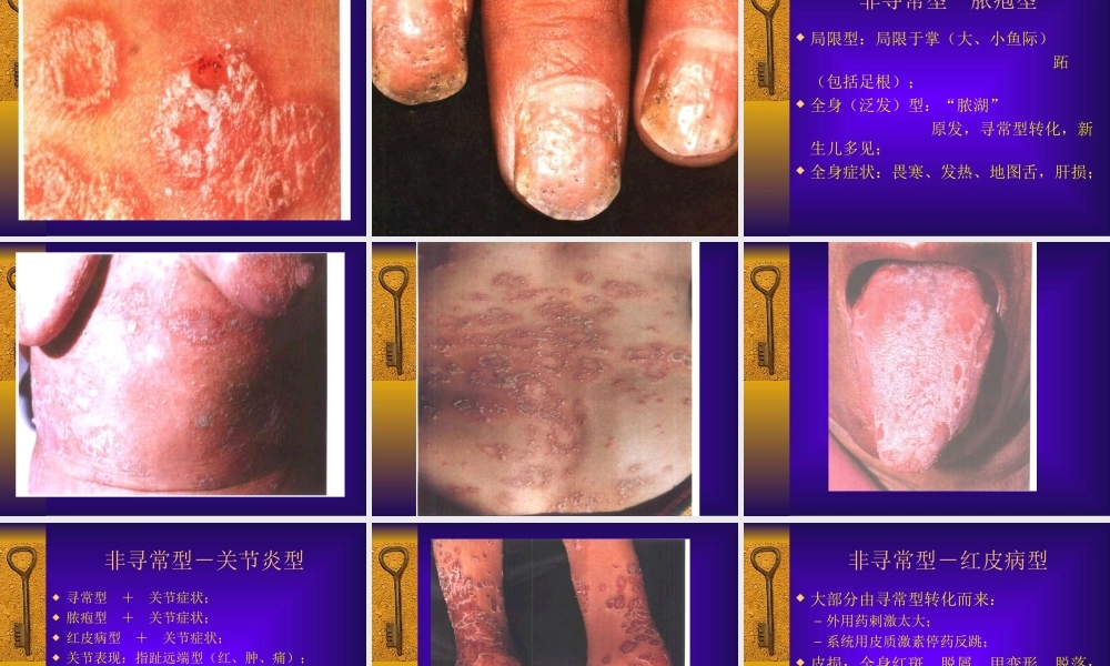 P-07红斑鳞屑性皮肤病.ppt