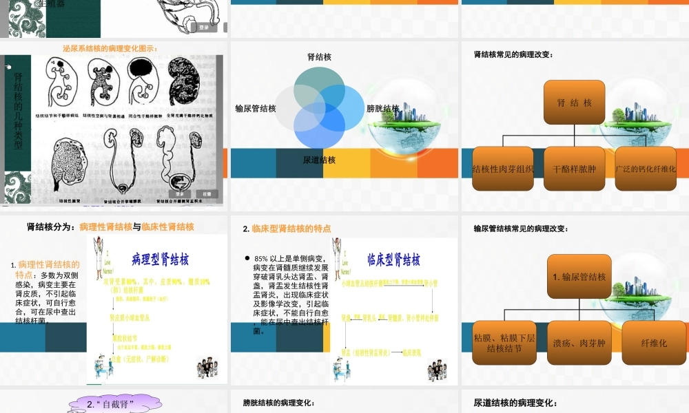 7-31查房-泌尿系结核.ppt