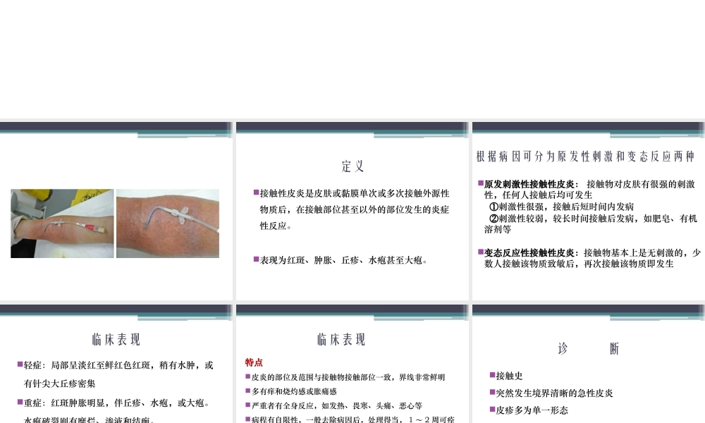 严重的接触性皮炎的处理..精讲.ppt