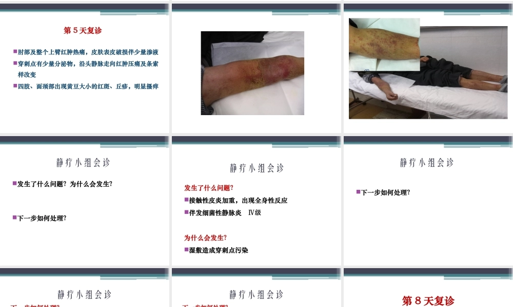 严重的接触性皮炎的处理..精讲.ppt