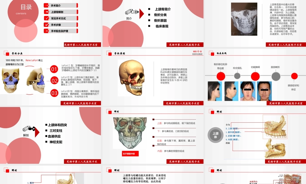 上颌骨骨折切开复位术的配合.pptx