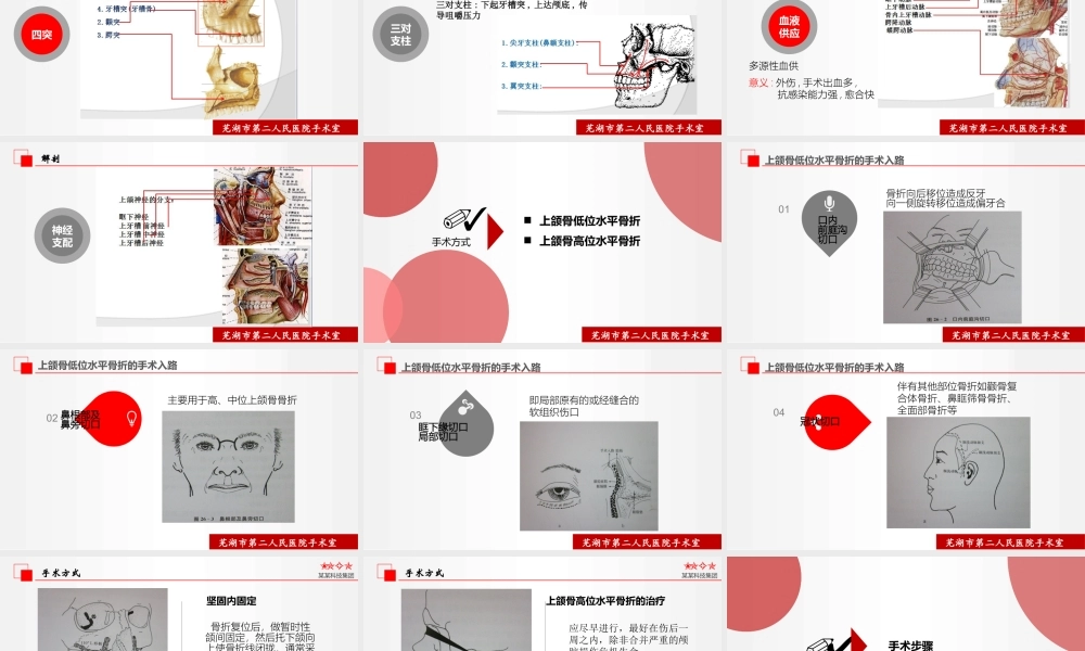 上颌骨骨折切开复位术的配合.pptx
