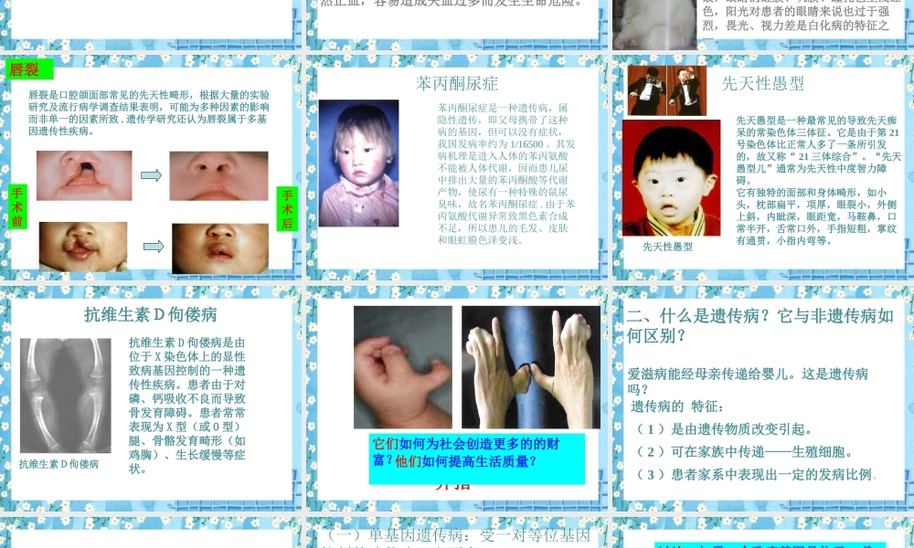 《遗传病和人类健康》PPT.pptx