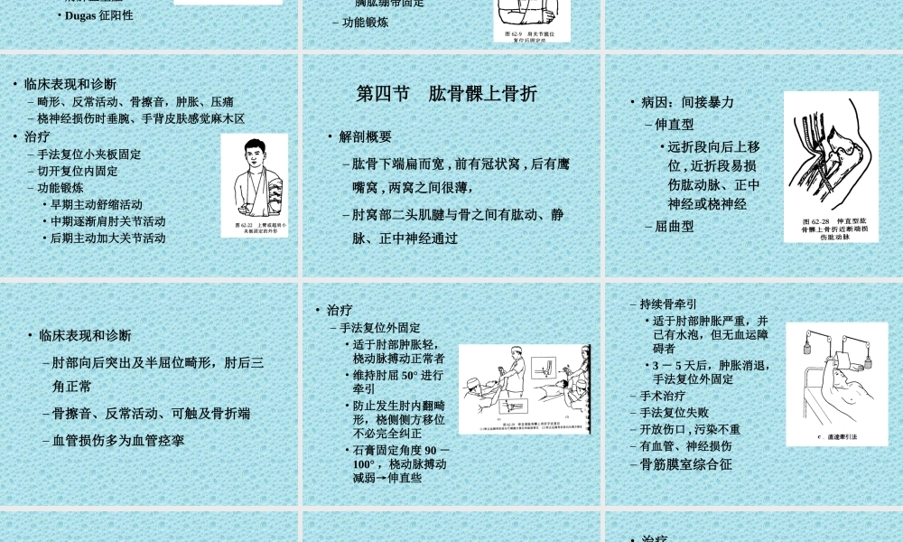 上肢骨、关节损伤.ppt