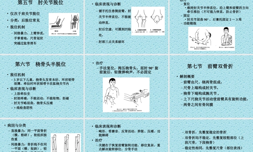 上肢骨、关节损伤.ppt