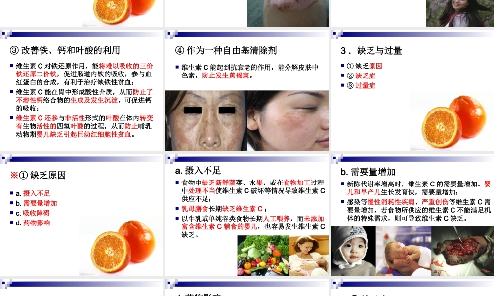 《食品营养与卫生》-第七讲-水溶性维生素-2016测试版.ppt