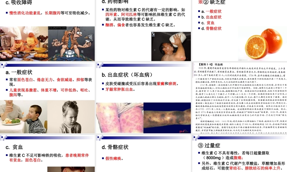 《食品营养与卫生》-第七讲-水溶性维生素-2016测试版.ppt