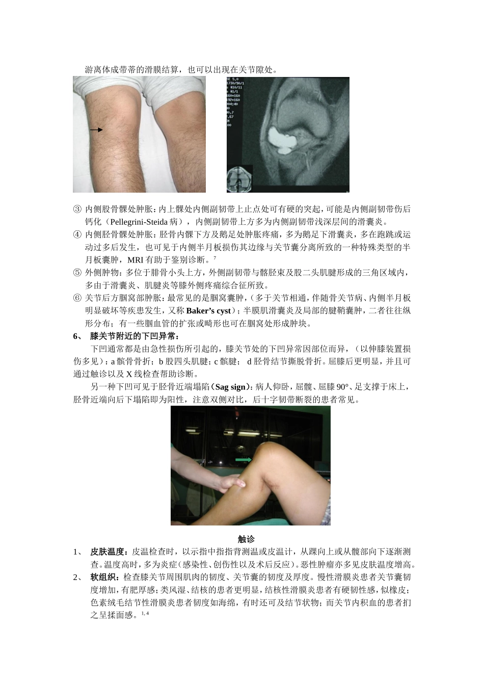 与膝关节镜手术相关疾患的膝关节检查法.doc_第3页