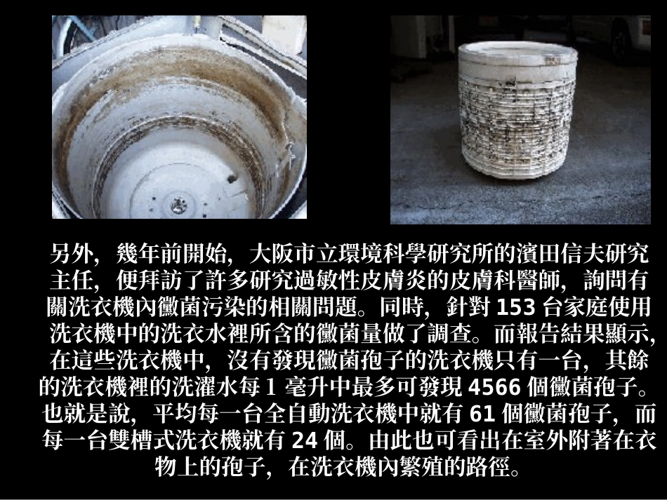 洗衣机的霉菌与异位性皮肤炎.ppt_第3页