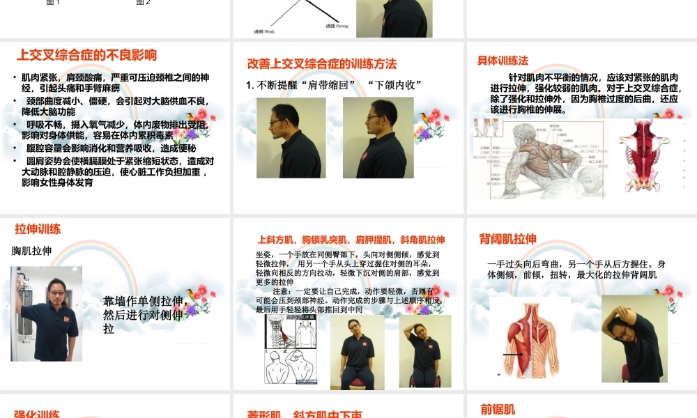 上交叉综合症.ppt