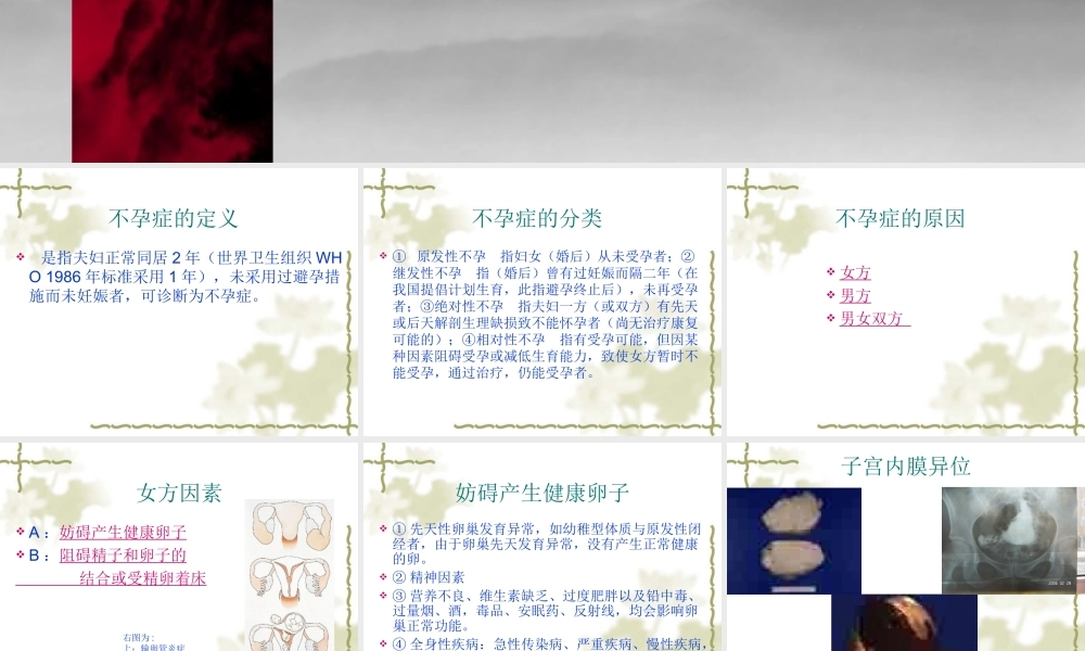 不孕症的定义概述.ppt