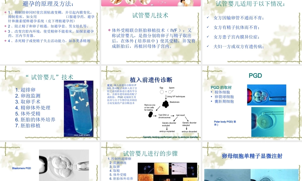 不孕症的定义概述.ppt
