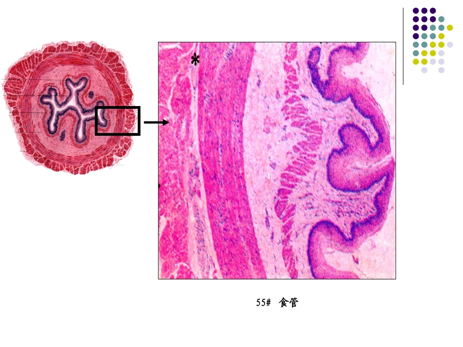 消化管48-2011.ppt_第3页