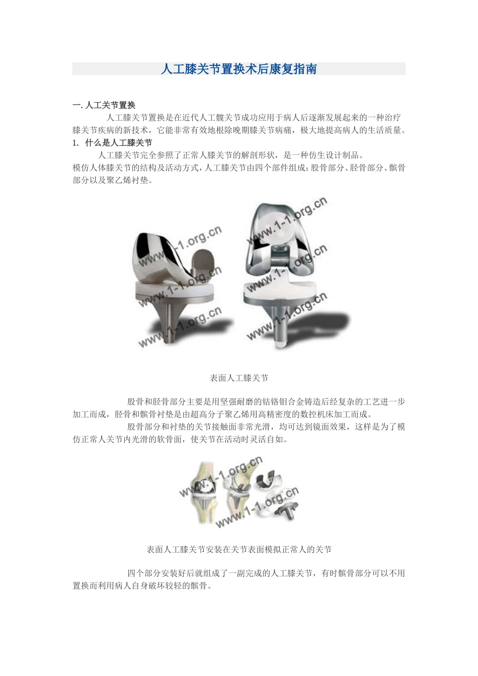 人工膝关节置换术后康复指南.doc_第1页