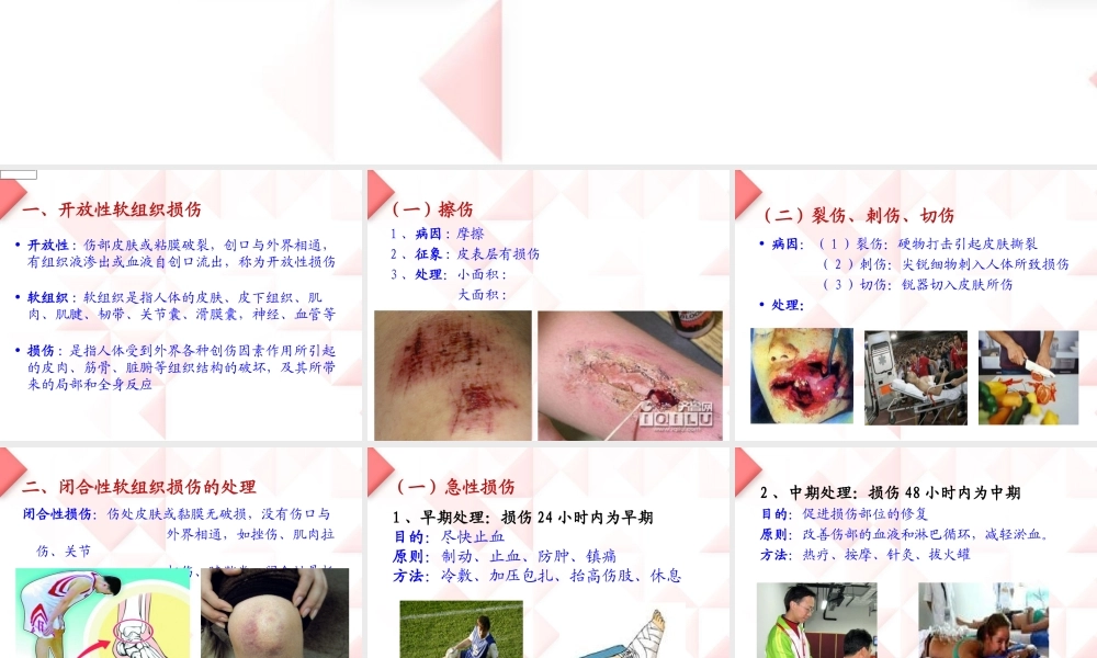 [资料]运动中常见损伤的理和急救.ppt