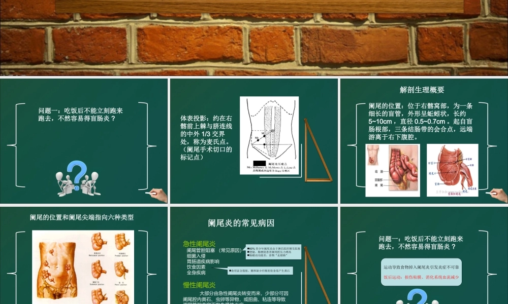 不可轻视的小病阑尾炎.ppt