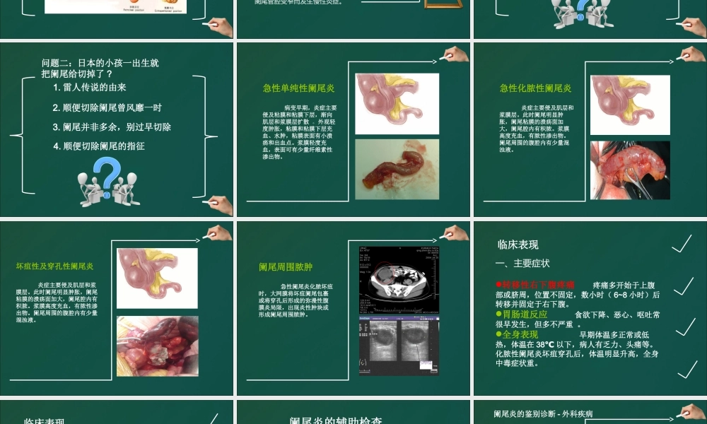 不可轻视的小病阑尾炎.ppt