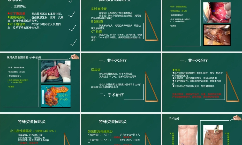 不可轻视的小病阑尾炎.ppt