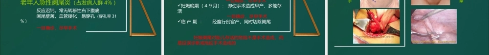 不可轻视的小病阑尾炎.ppt
