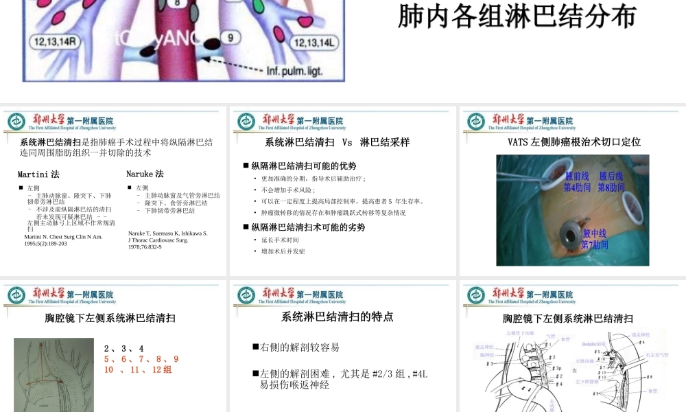 VATS左侧肺癌根治术中的淋巴结清扫---胸外科.ppt