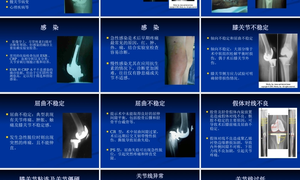 【王坤正】全膝关节置换术后膝关节疼痛的原因分析及处理.pptx