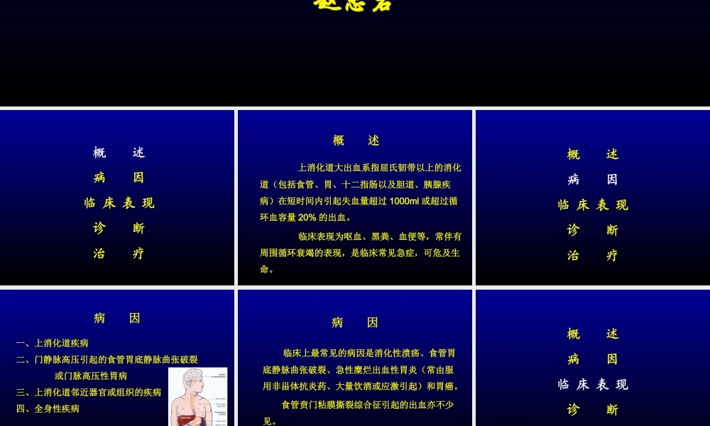 上消化道大出血(急).ppt