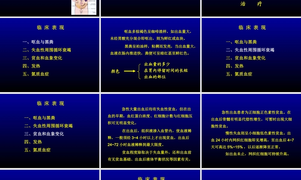 上消化道大出血(急).ppt