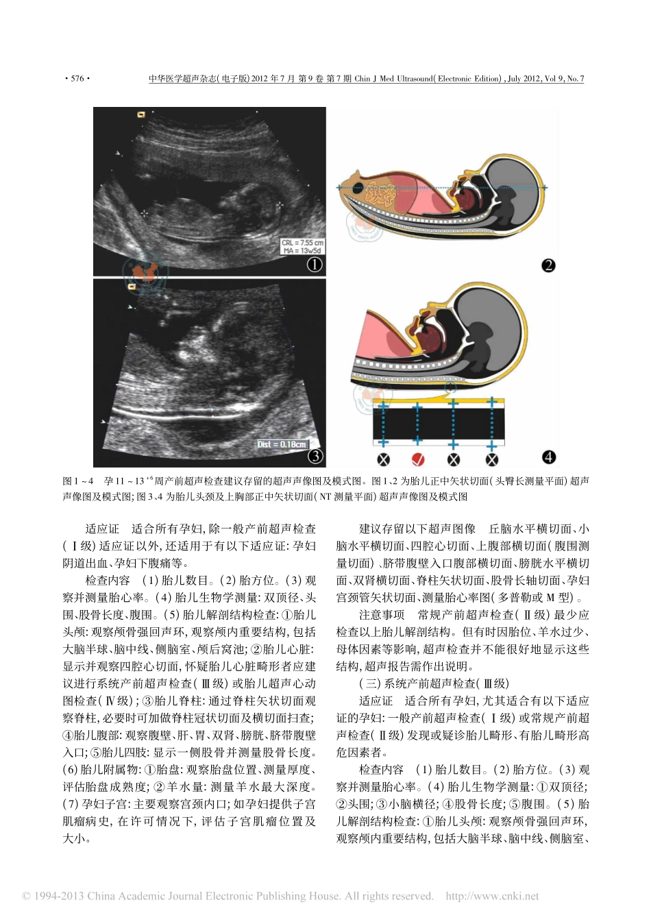产前超声检查指南(2012).pdf_第3页