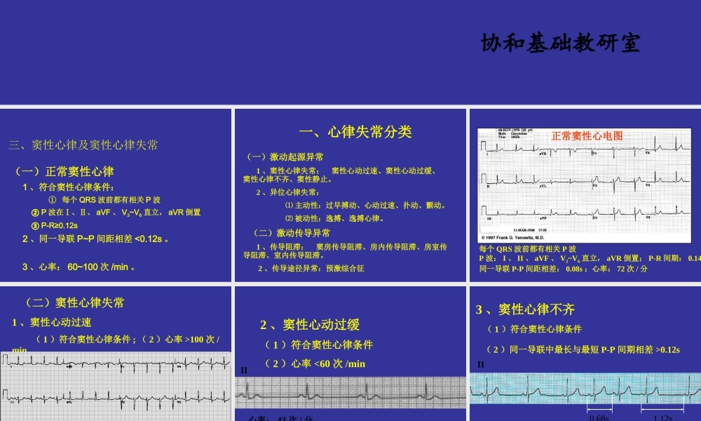 中国协和医院心电图详解.ppt