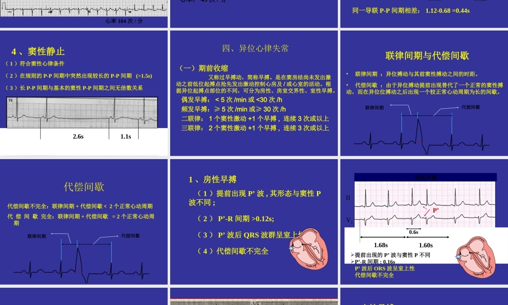 中国协和医院心电图详解.ppt