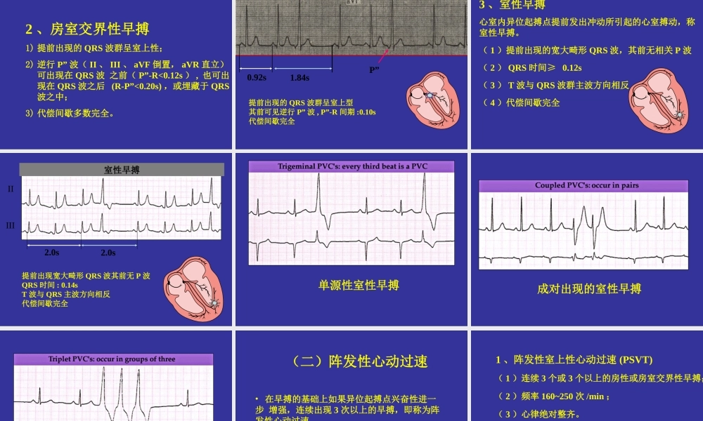 中国协和医院心电图详解.ppt