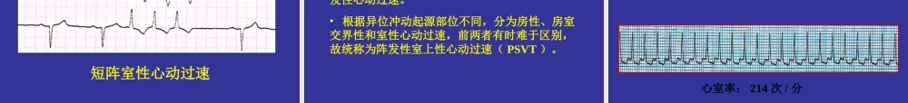 中国协和医院心电图详解.ppt