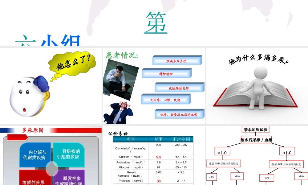 中枢性尿崩症Centraldiabetesinspidus.ppt