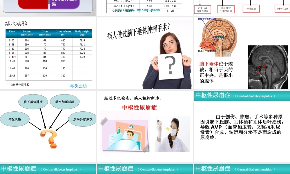 中枢性尿崩症Centraldiabetesinspidus.ppt