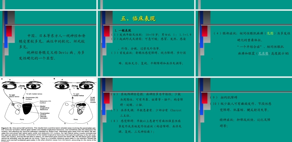 中枢神经系统脱髓壳病(详细).ppt