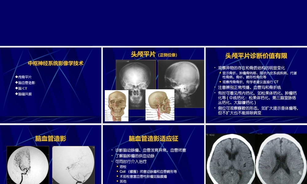 中枢神经系统正常及异常影像改变(北京协和医院).ppt