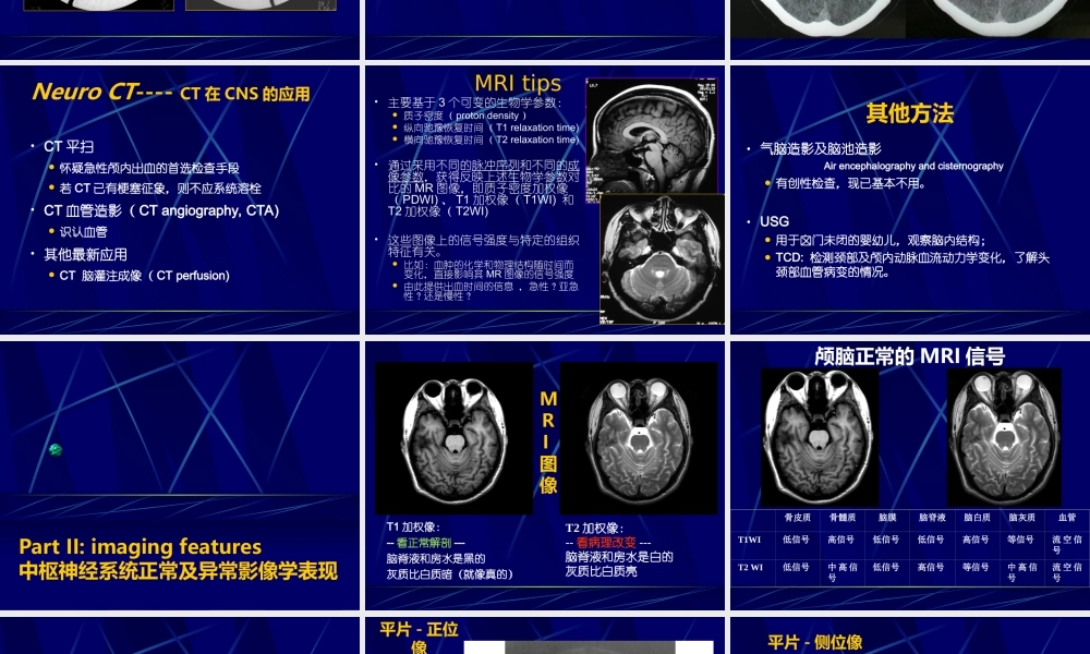 中枢神经系统正常及异常影像改变(北京协和医院).ppt