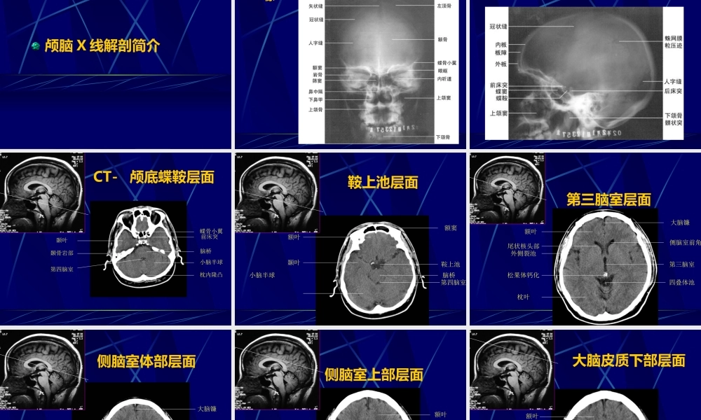 中枢神经系统正常及异常影像改变(北京协和医院).ppt