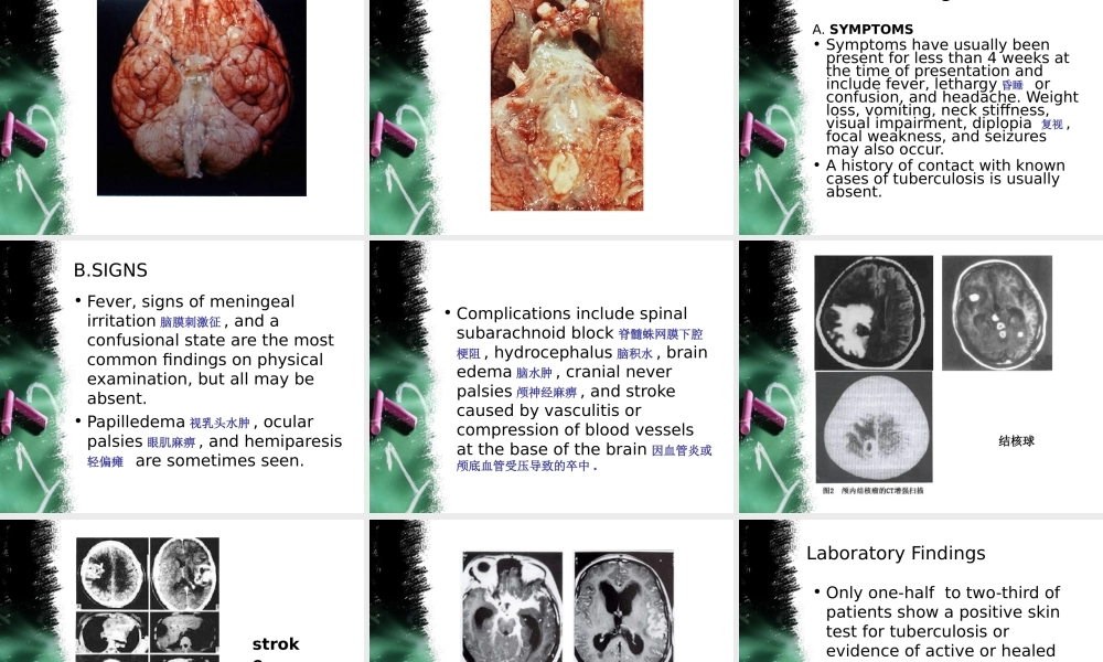 中枢神经系统感染-2.ppt.ppt