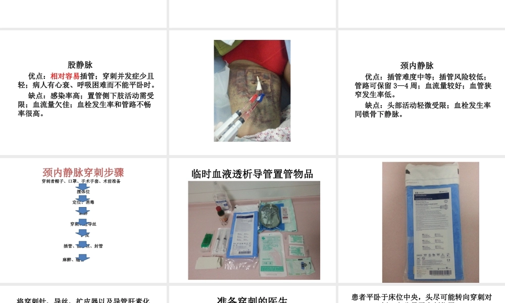 临时血液透析导管置管术.ppt