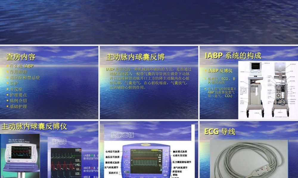 主动脉内球囊反博概述.ppt