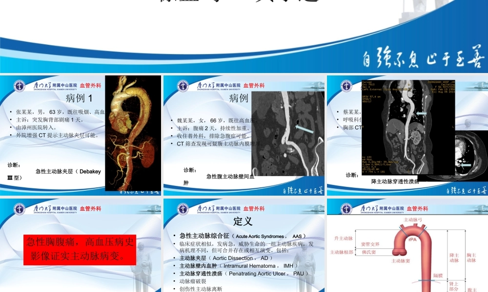 主动脉壁间血肿与穿透性溃疡.ppt