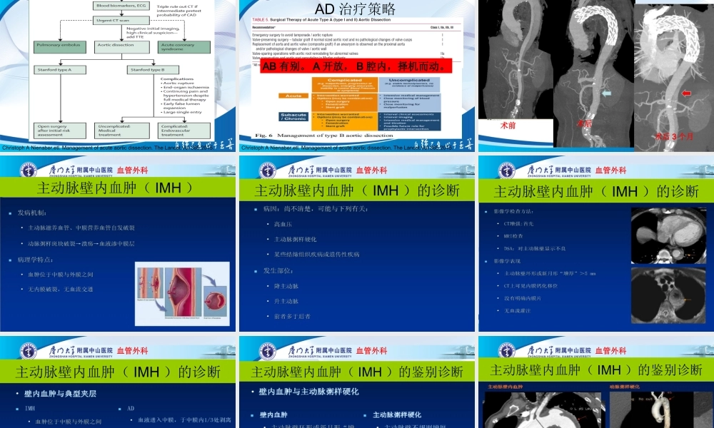 主动脉壁间血肿与穿透性溃疡.ppt