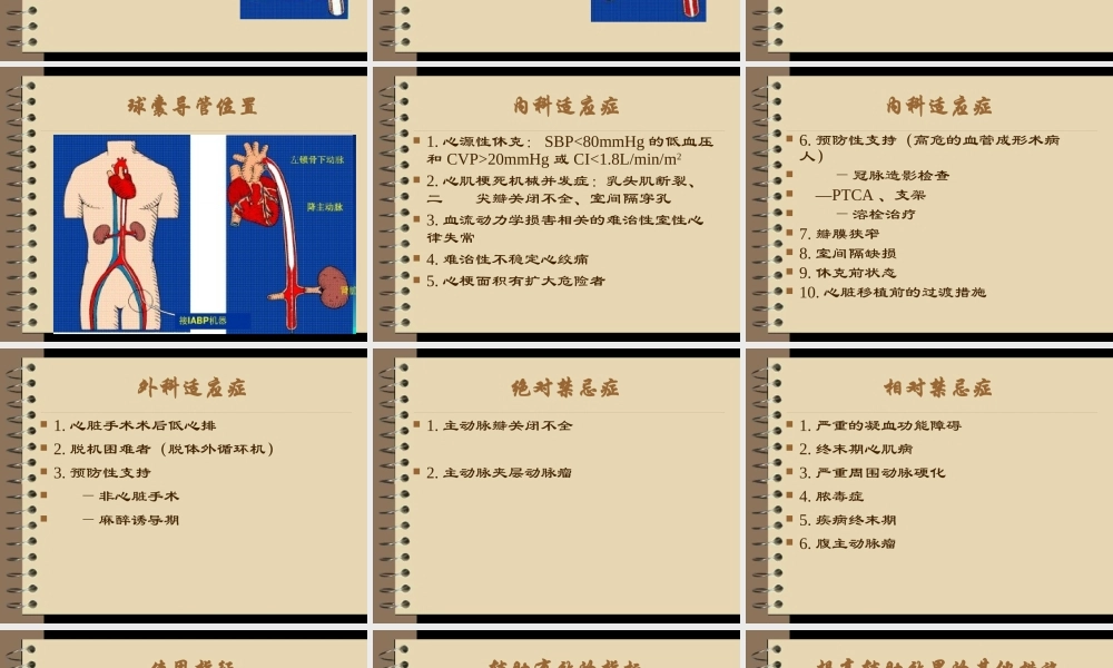 主动脉球囊反搏术.ppt